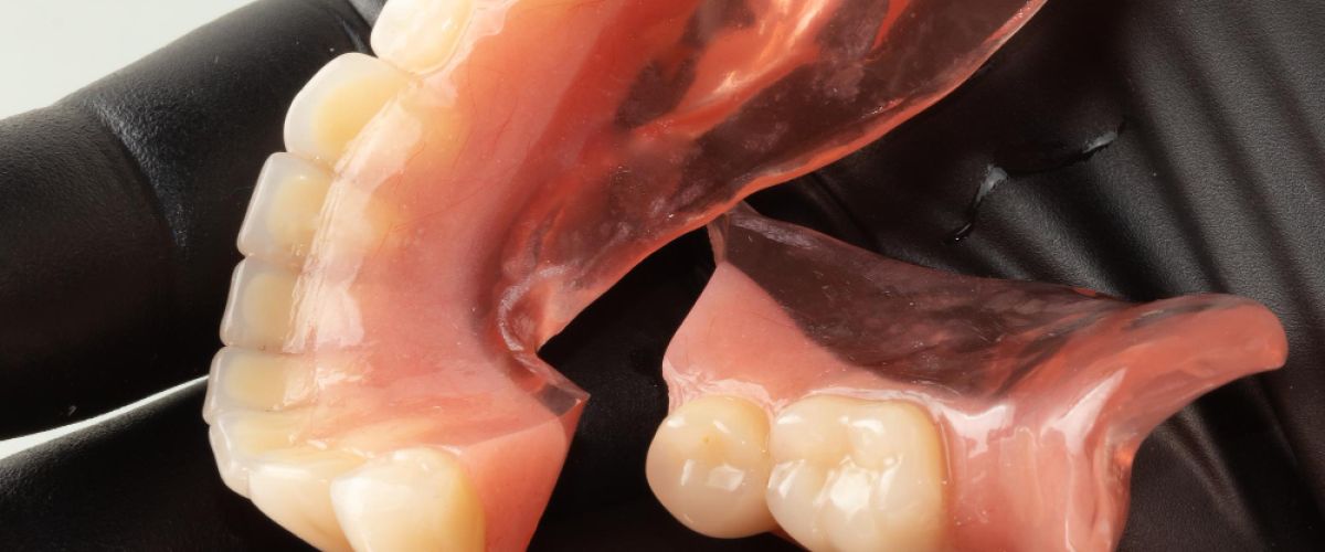 broken denture