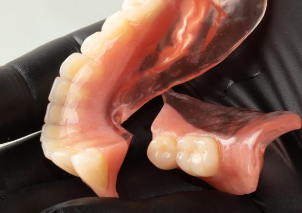 broken denture