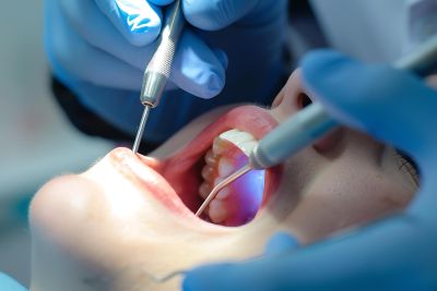 woman having root canal treatment